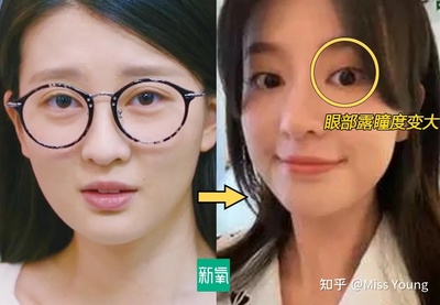 眼窝凹陷面相