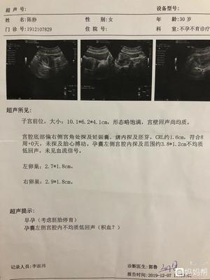 怀孕空囊的原因
