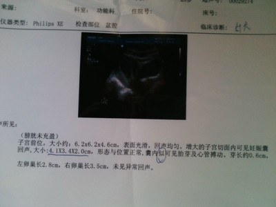 怀孕50天做什么检查