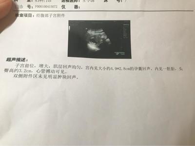 查怀孕抽血
