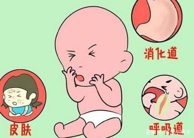 宝宝过敏的症状