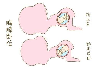 怀孕多久定胎位