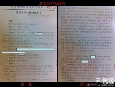 关于尸检的法律规定