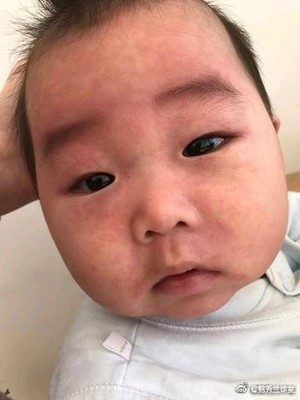 宝宝发烧抽搐正常吗