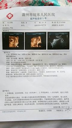 带环怀孕几率多大