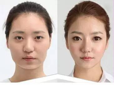 脸型变化