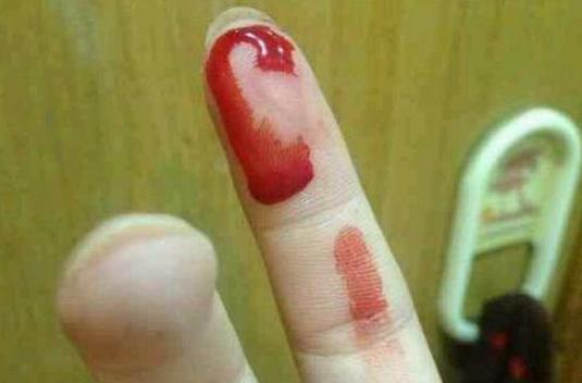 梦见自己手指流血