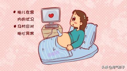胎心监护胎儿不动