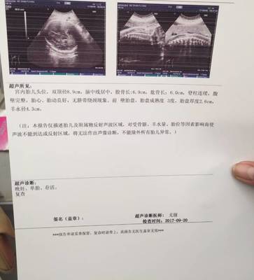 孕35周几个月