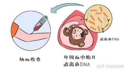 怀孕期间能不能做亲子鉴定