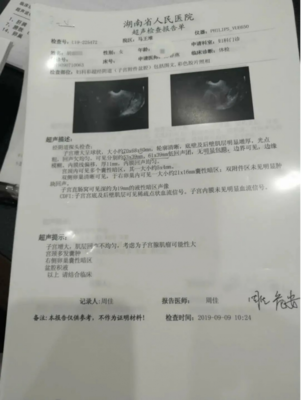 乳腺低回声结节是怎么回事