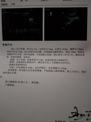 胎盘在右侧壁胎儿图片