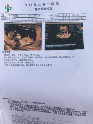 怀孕多久做nt和唐筛