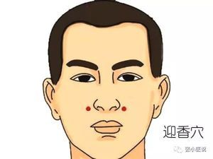 针灸治痘痘扎那个部位
