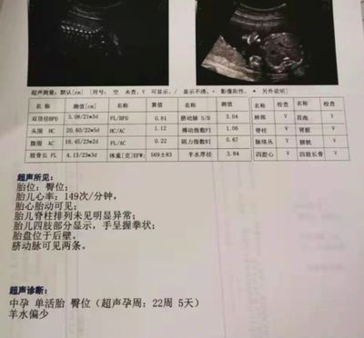 胎儿fl标准对照表