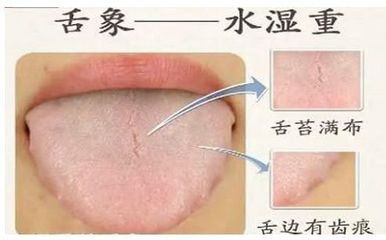 舌头有点肿是怎么回事
