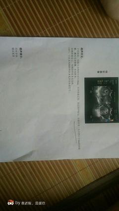 做流产需要家属签字吗