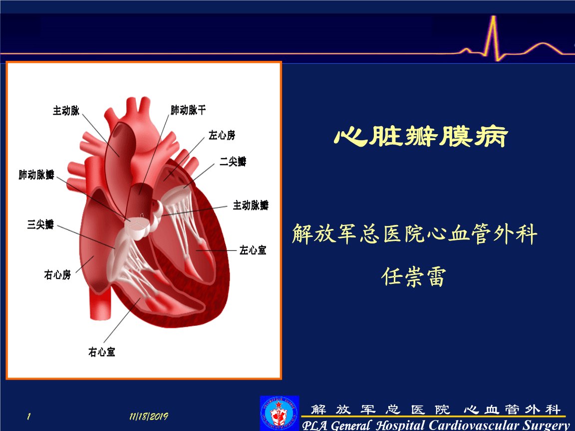 主动脉型心脏怎么治疗