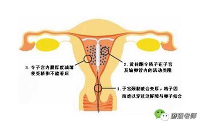 带环怎么还会怀孕