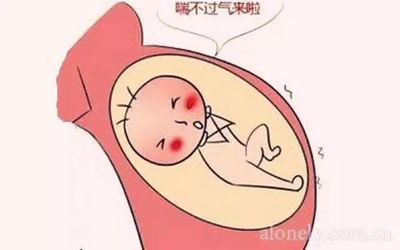 孕妇喘不过来气