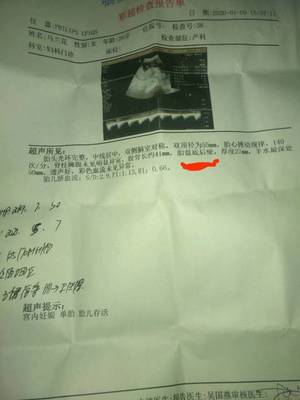 怀孕22周胎动频繁正常吗