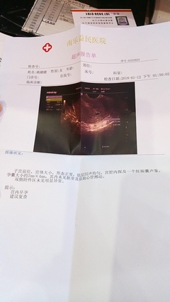 怀孕几天能看到孕囊