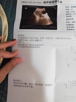 怎么看怀孕没