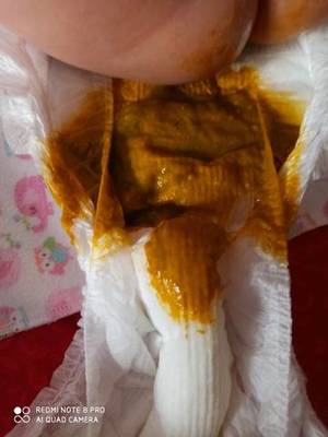 宝宝的便便有酸臭味