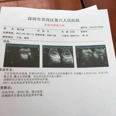怀孕五周孕吐正常吗