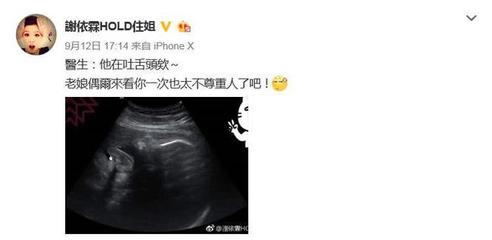 一般怀孕几个月会吐