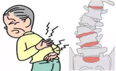 老人脊柱侧弯怎么治疗