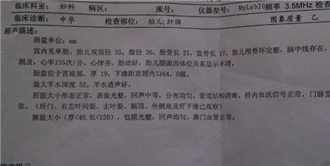 怀孕11周宝宝多大图片