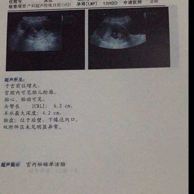 怀孕十三周是几个月