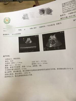 怀孕36周脐带绕颈两周怎么办