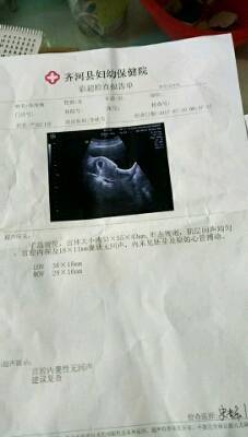 怀孕流褐色血