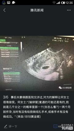 结扎三年了还会怀孕吗