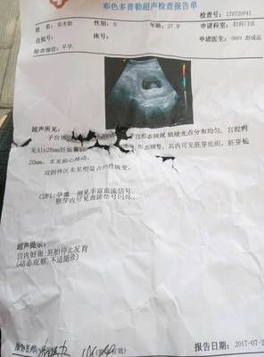 怀孕几天怎么打掉