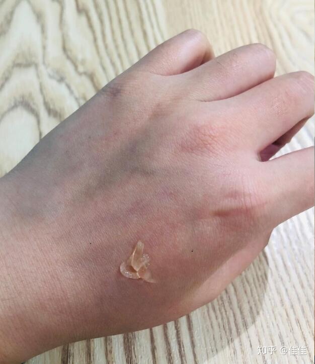 有什么祛痘印的好方法