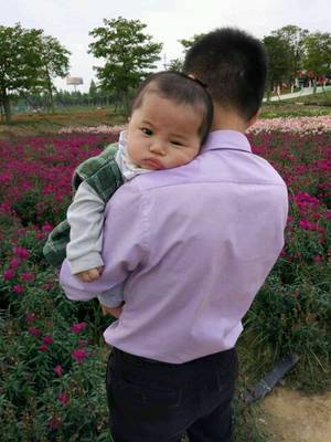 宝宝手被烫红了怎么办