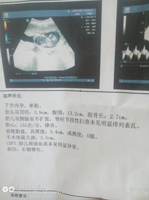 五个多月的胎儿有多大