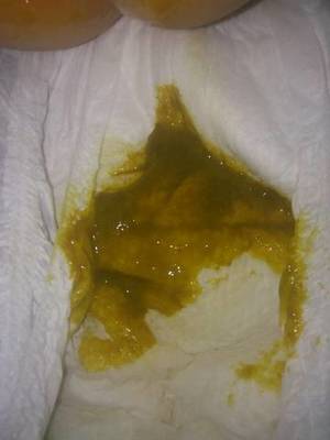 宝宝的便便有酸臭味