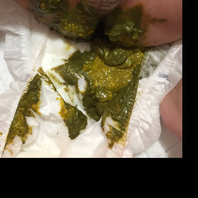 拉的粑粑是绿色的怎么回事