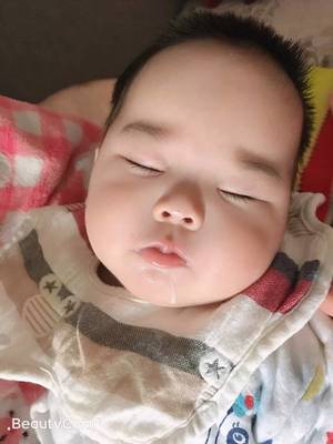 两个月宝宝过敏图片