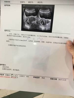 三十天能查出怀孕吗