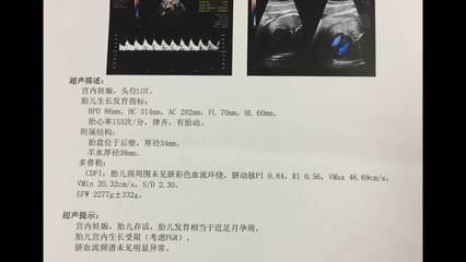 fgr胎儿