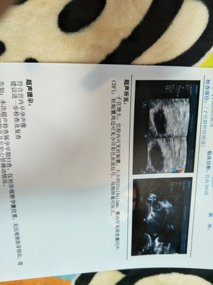 53岁月经停2个月又来了
