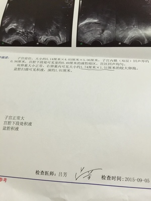 卵泡长不大会怀孕吗