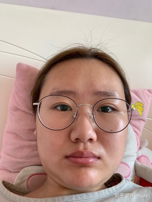 做梦割双眼皮什么意思