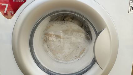 宝宝白色胎记的形状图