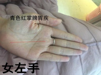 左手发抖是怎么回事